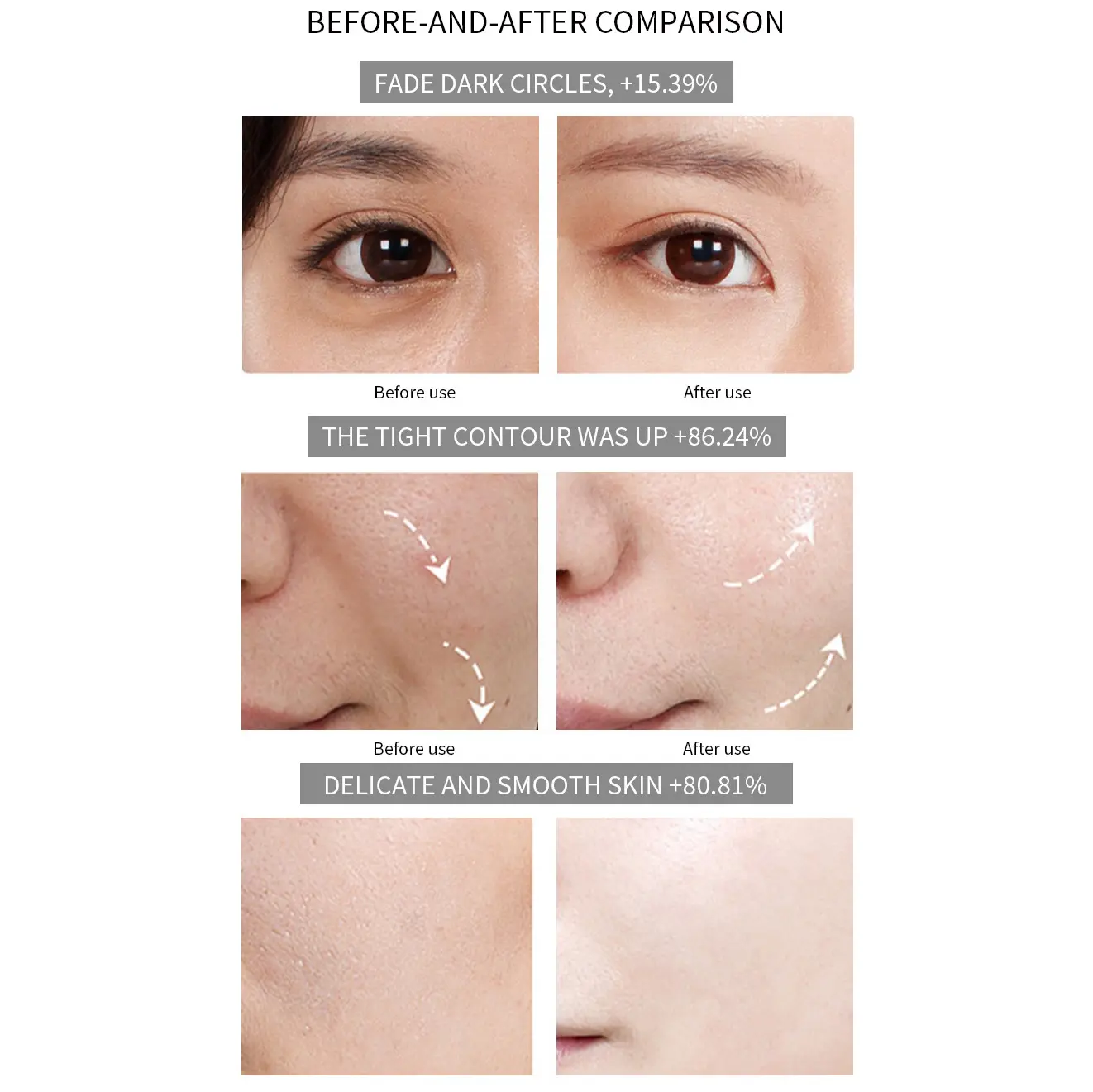 Before and After Comparison