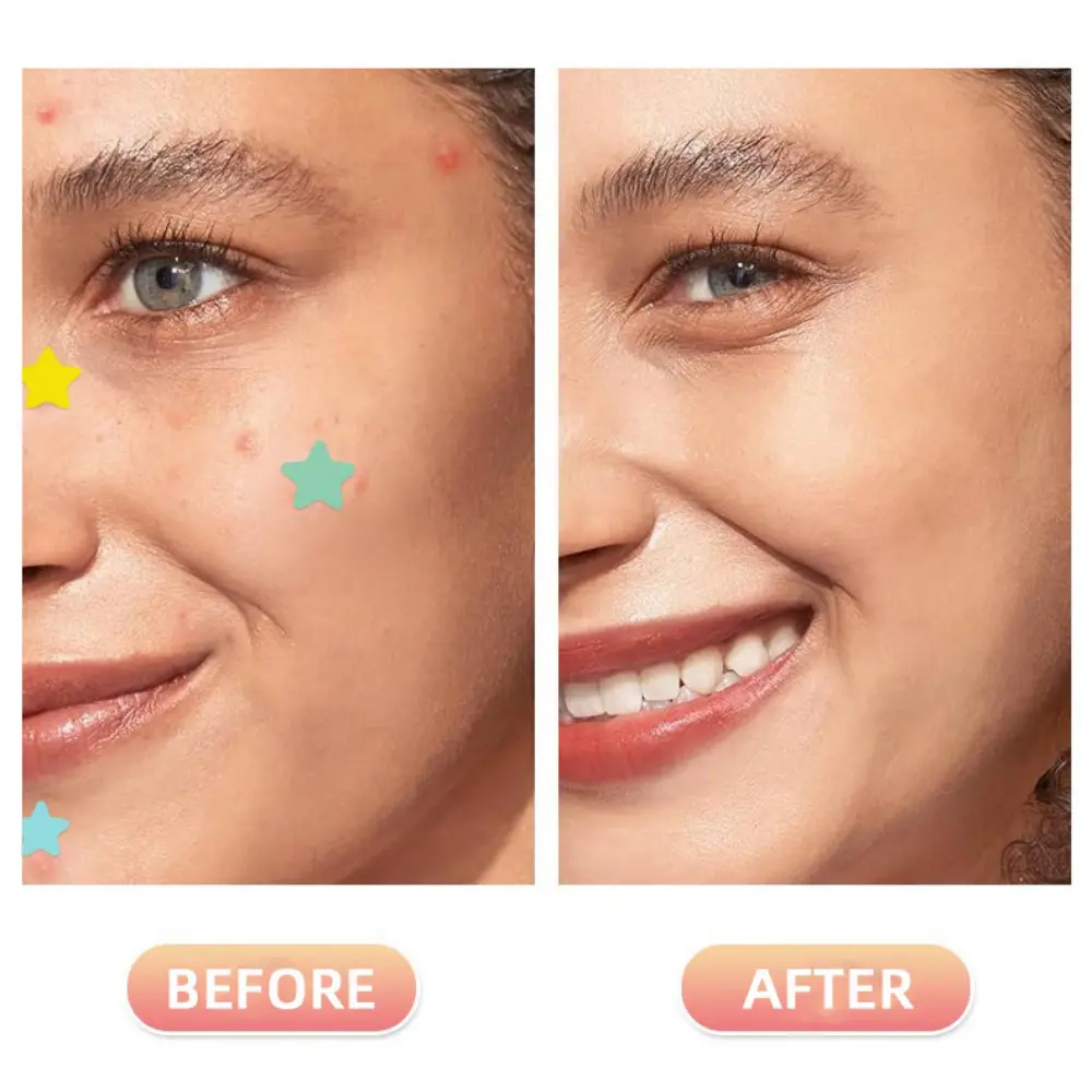 Pimple Manufacturers Plus Label Private Star Patches Acne Patch (7).jpg