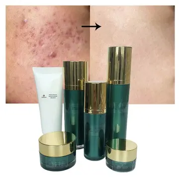 Anti-acne Removing Marks Skincare Set Tea Tree Essential Oil Organic Oil Control